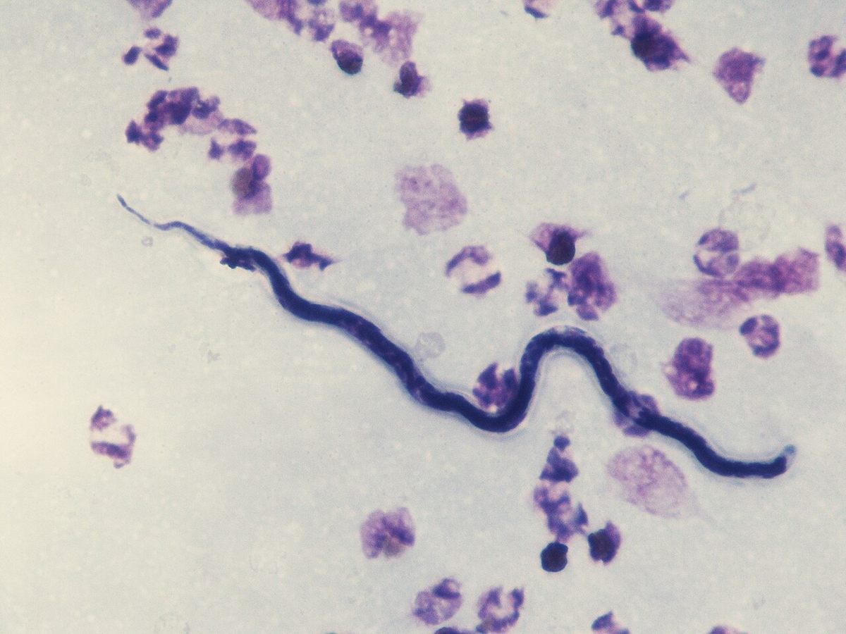 Photo of African Eye Worm (Loa loa)