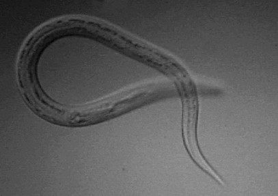 Photo of American Hookworm (Necator americanus)