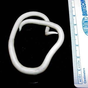 Photo of Giant Roundworm (Ascaris lumbricoides)