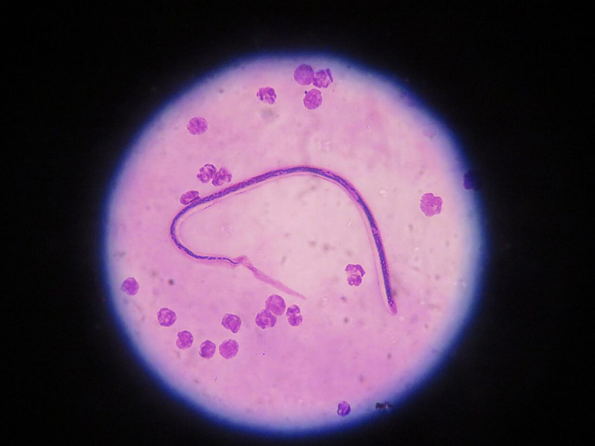 Photo of Bancroft's Filarial Worm (Wuchereria bancrofti)
