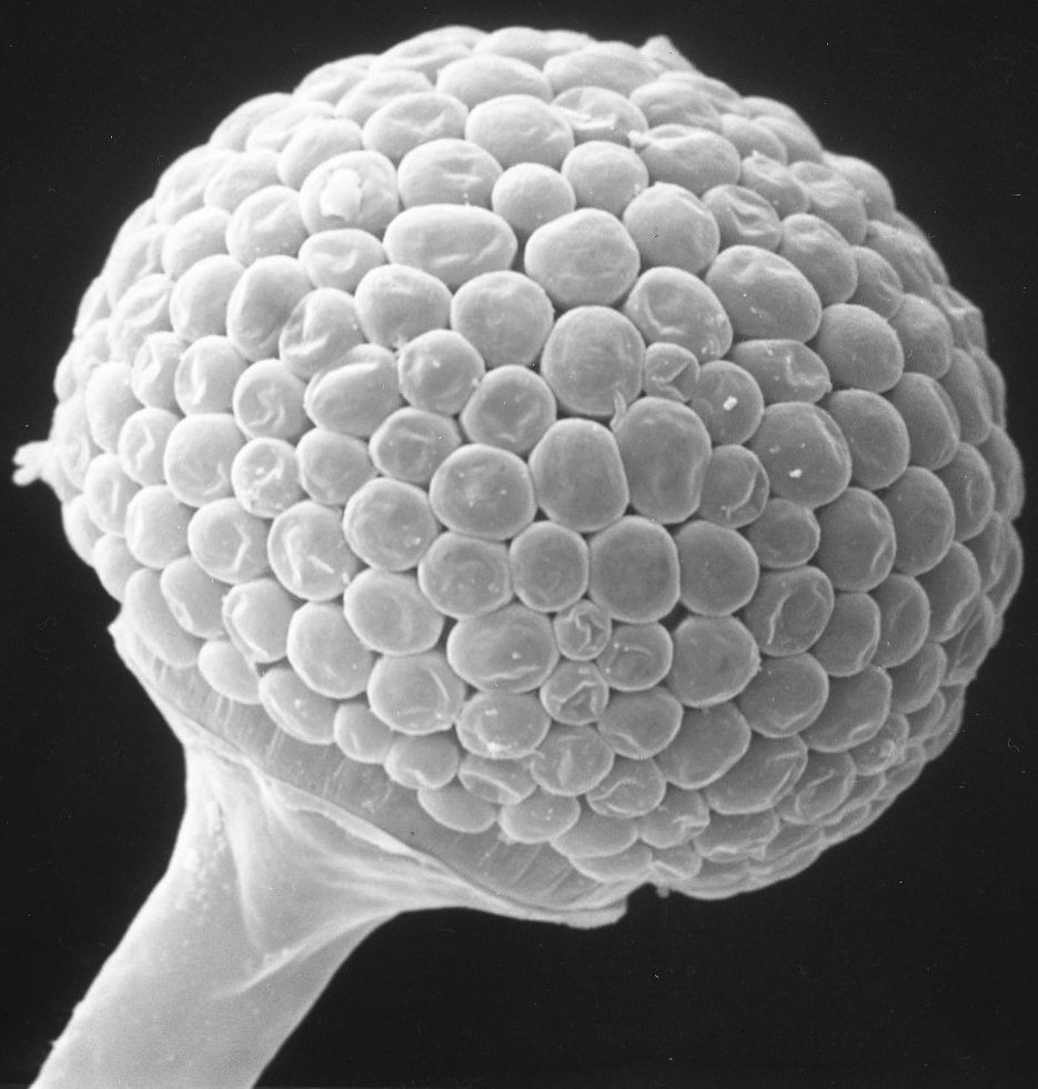 Photo of Black Bread Mold (Rhizopus stolonifer)