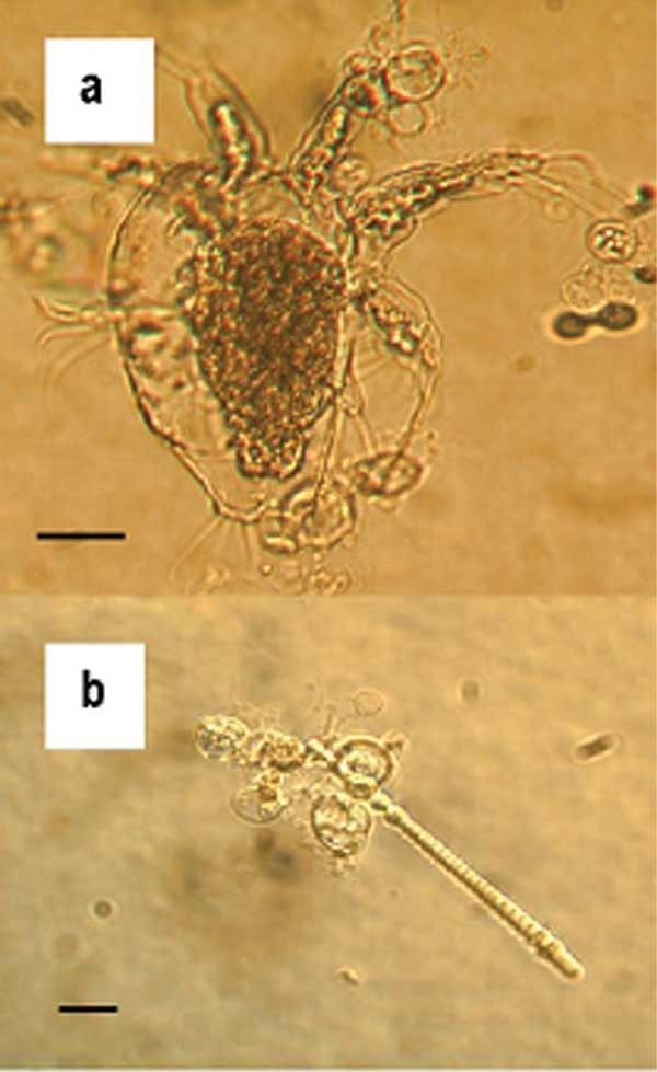 Photo of Amphibian Chytrid Fungus (Batrachochytrium dendrobatidis)