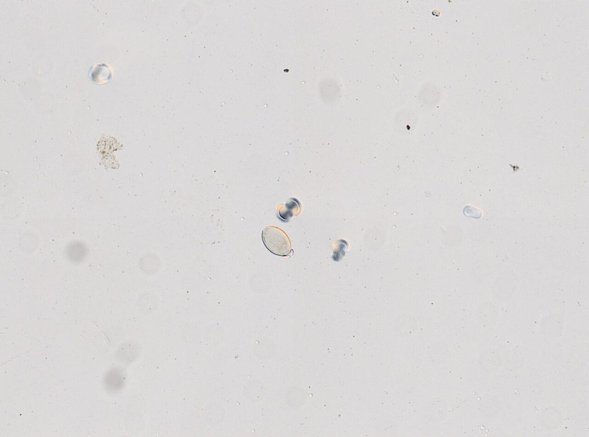 Specimen photo of Dog Whipworm (Trichuris vulpis)