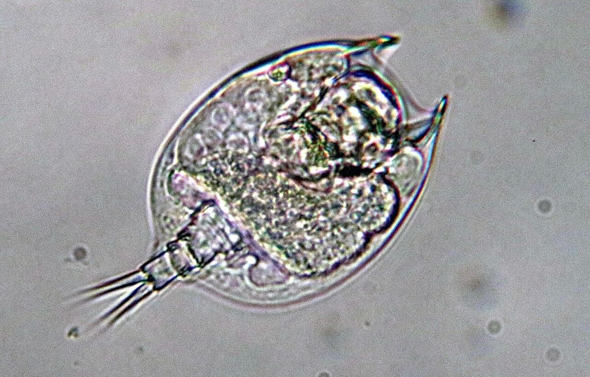 Photo of Euchlanis Rotifer (Euchlanis dilatata)