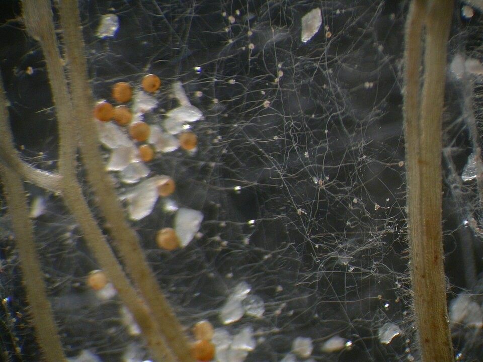 Photo of Giant Spore Soil Fungus (Gigaspora margarita)