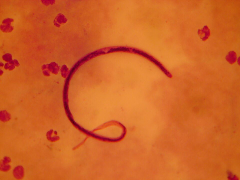 Photo of Malayan Filarial Worm (Brugia malayi)