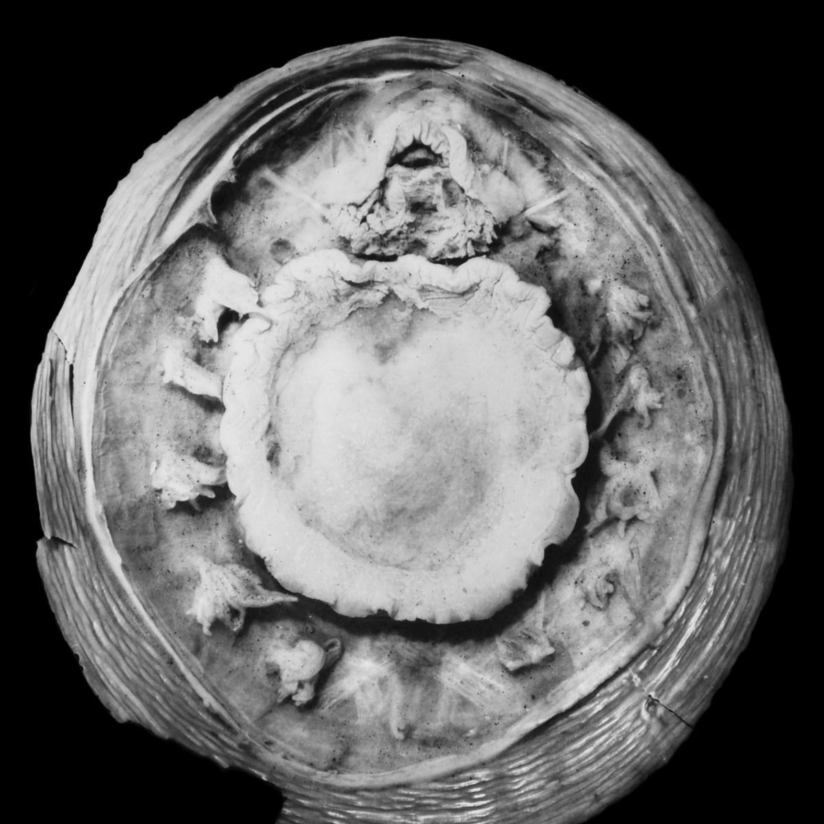 Specimen photo of Neopilina Deep-Sea Limpet (Neopilina galatheae)