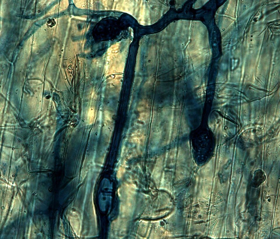 Photo of Arbuscular Mycorrhizal Soil Fungus (Rhizophagus irregularis)