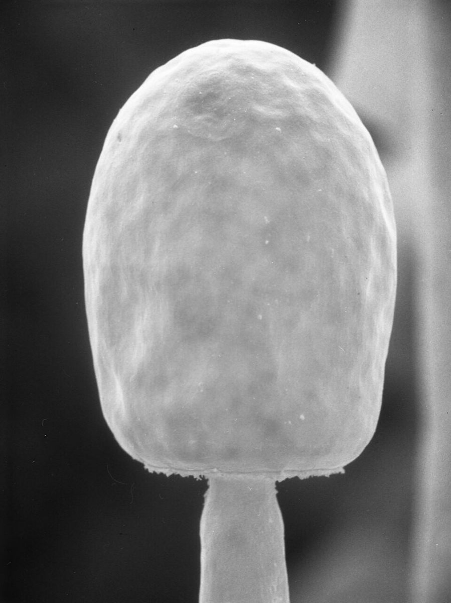 Photo of Common Pinmold (Mucor mucedo)