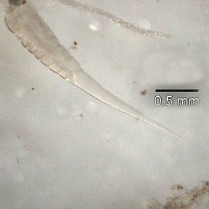 Photo of Human Pinworm (Enterobius vermicularis)