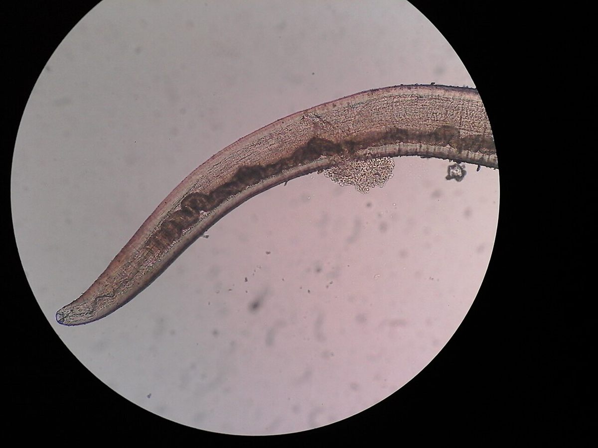 Photo of River Blindness Worm (Onchocerca volvulus)