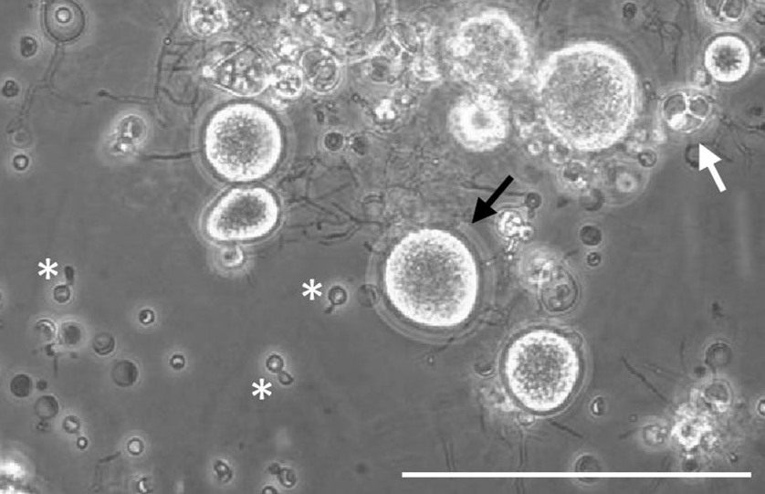 Specimen photo of Salamander Chytrid Fungus (Batrachochytrium salamandrivorans)
