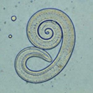 Photo of Pork Muscle Worm (Trichinella spiralis)
