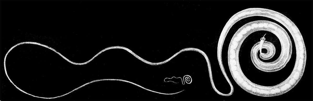 Photo of Human Whipworm (Trichuris trichiura)